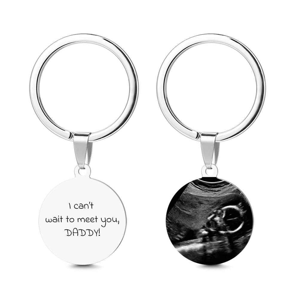 Personalized Ultrasound Photo Keychain - Custom Baby Sonogram Keepsake